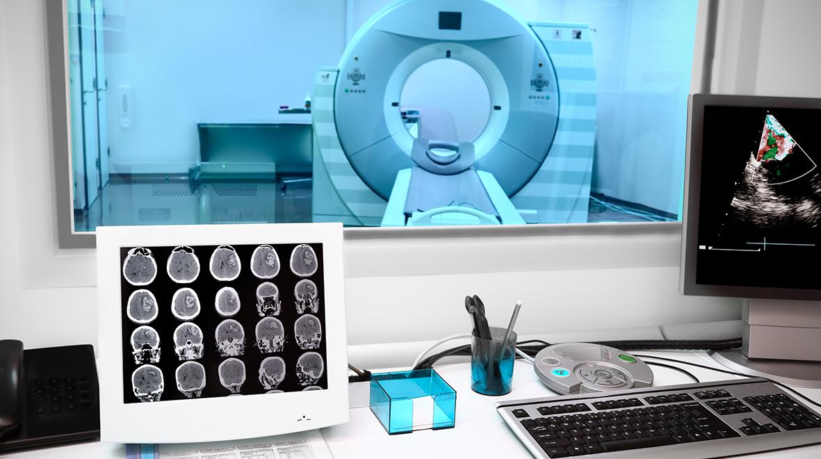 Visual representation of challenges and solutions in medical image analysis using AI